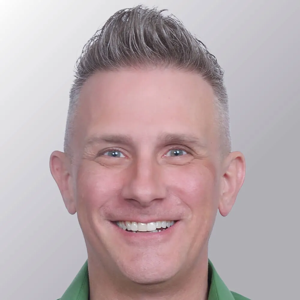 Kevin B. after hair transplant
