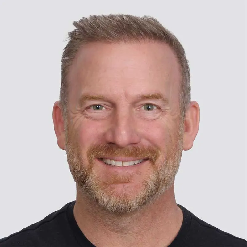 Ryan Dempster after hair transplant