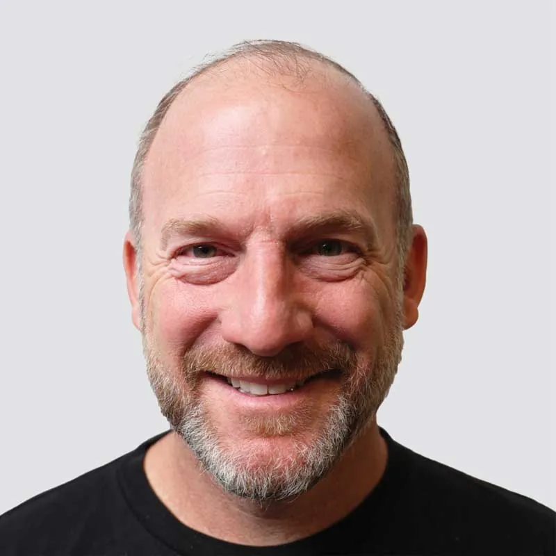 Ryan Dempster before hair transplant