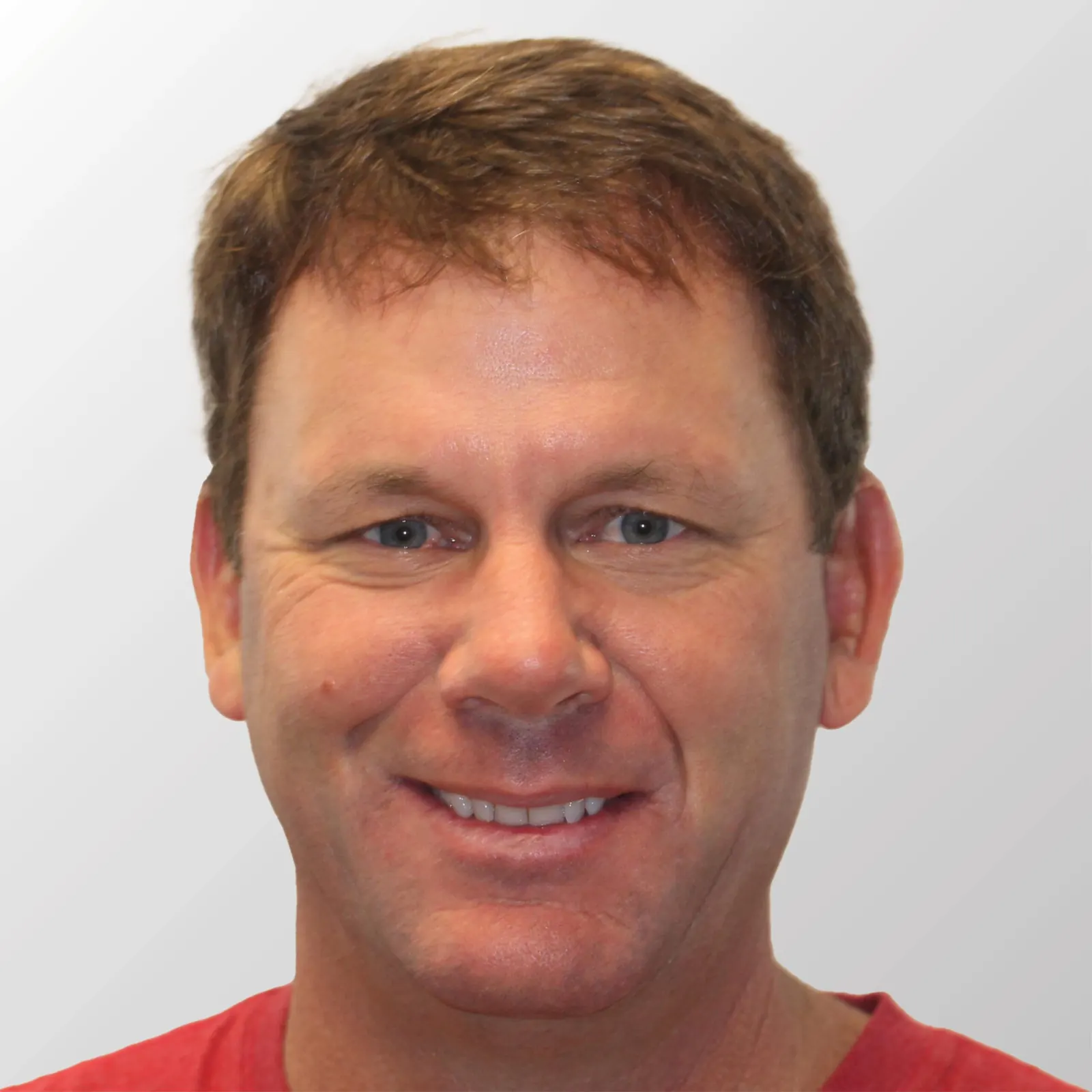 Kevin VanDam before hair transplant